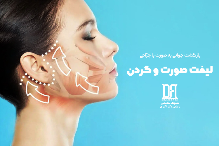 لیفت کلاسیک صورت و گردن
